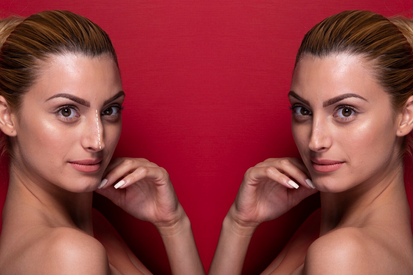rhinoplasty-surgery-concept-with-woman-model_23-2150036921